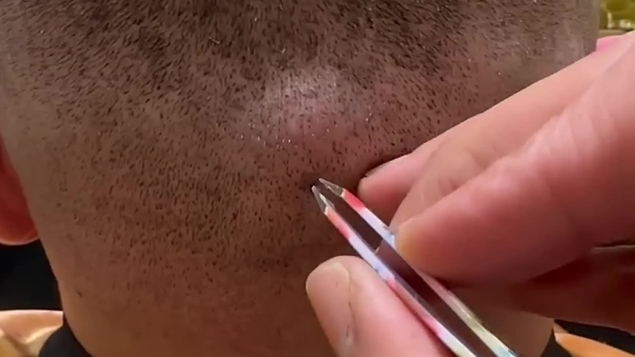 force trapped in the body