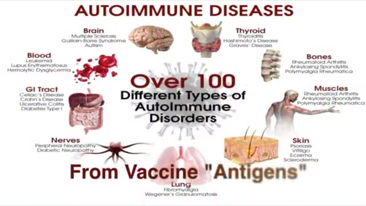 URGENT ALERT - NATURAL REMEDIES FOR COVID VACCINE ILLNESSES - Dr. Lonard Horowitz