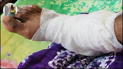 Bike accident