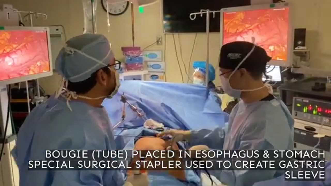 Experience a Live Gastric Sleeve Surgery Performed by Dr. Michael Renfrow