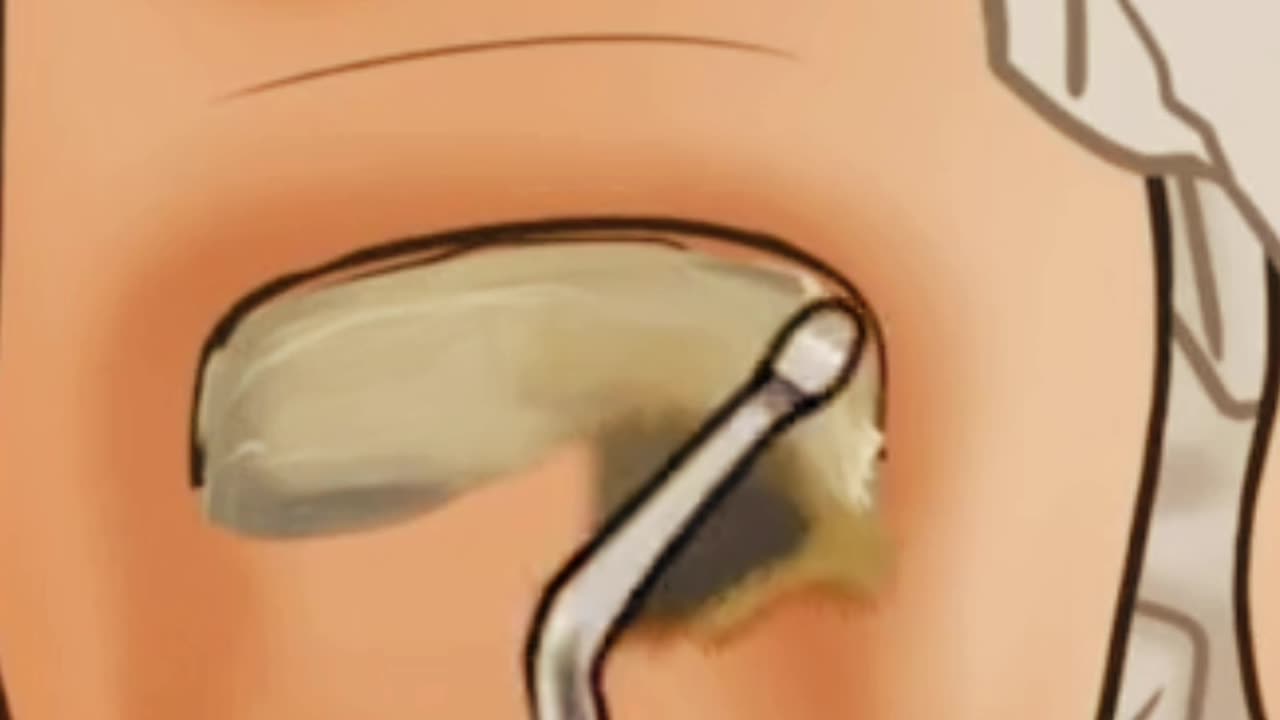 #ASMR TREATMENT