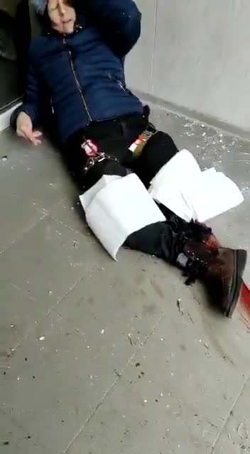 Man has Both Legs Injured by Bombing in Ukraine