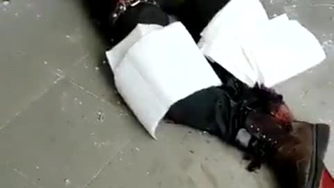 Man has Both Legs Injured by Bombing in Ukraine