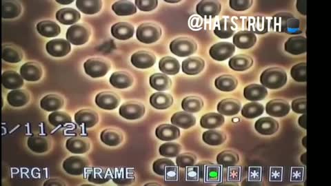 Microscopic view of blood cells