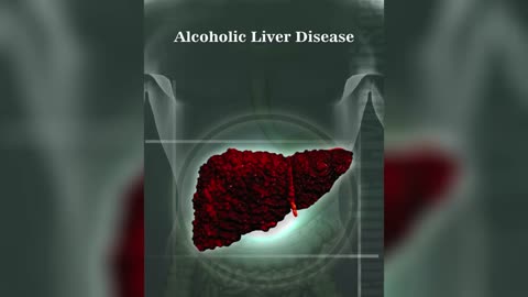 Alcoholic Liver Disease