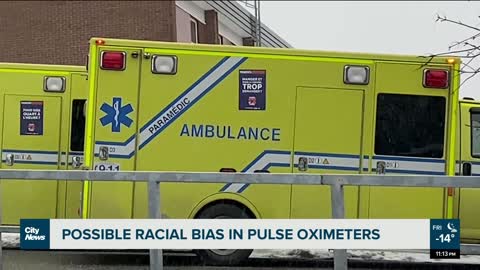 Possible racial bias in pulse oximeters- NEWS OF WORLD