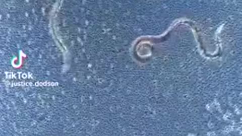 Ivermectin demonstration of killing parasites