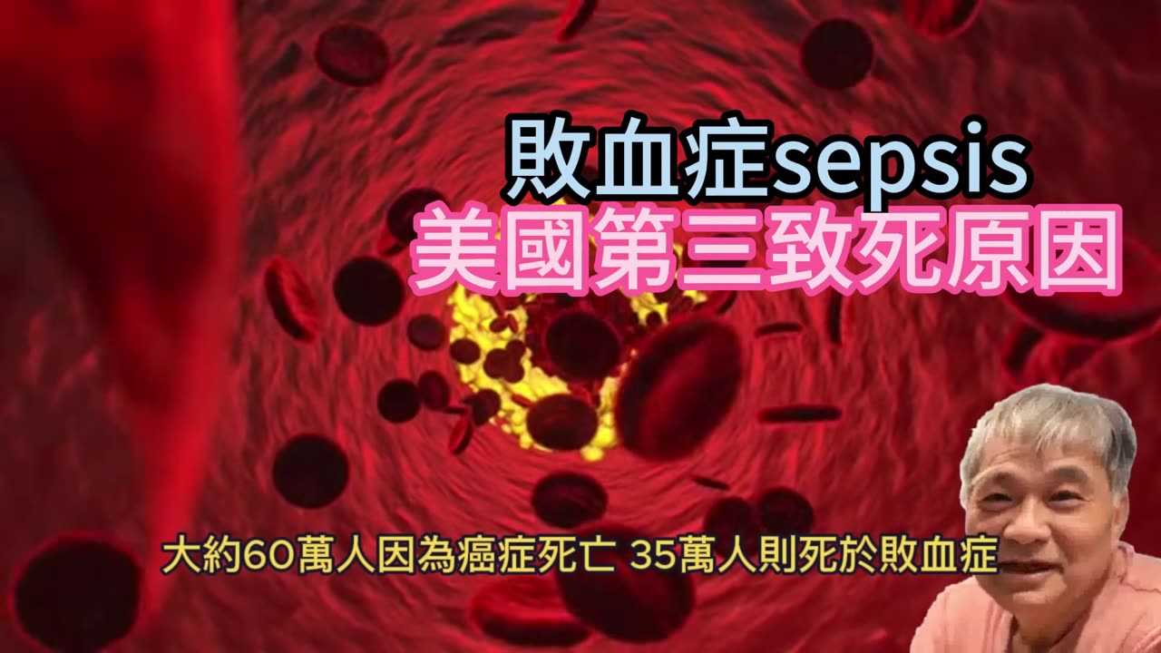 敗血症sepsis 美國第三致死原因