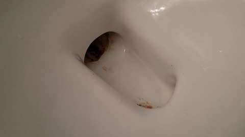 How to get rid of the buildup in your toilet