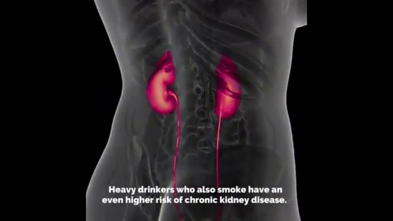 KIDNEY