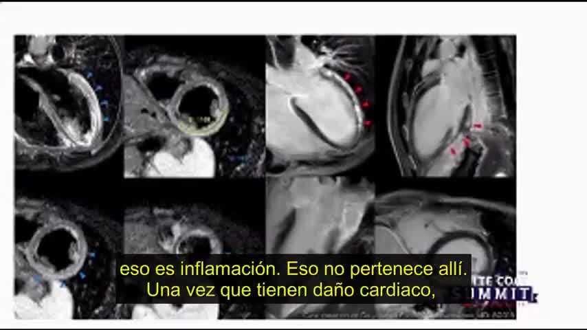 DR. RYAN COLE. EFECTOS ADVERSOS EN VACUNACIÓN ANTI COVID-19. AUTOPSIAS