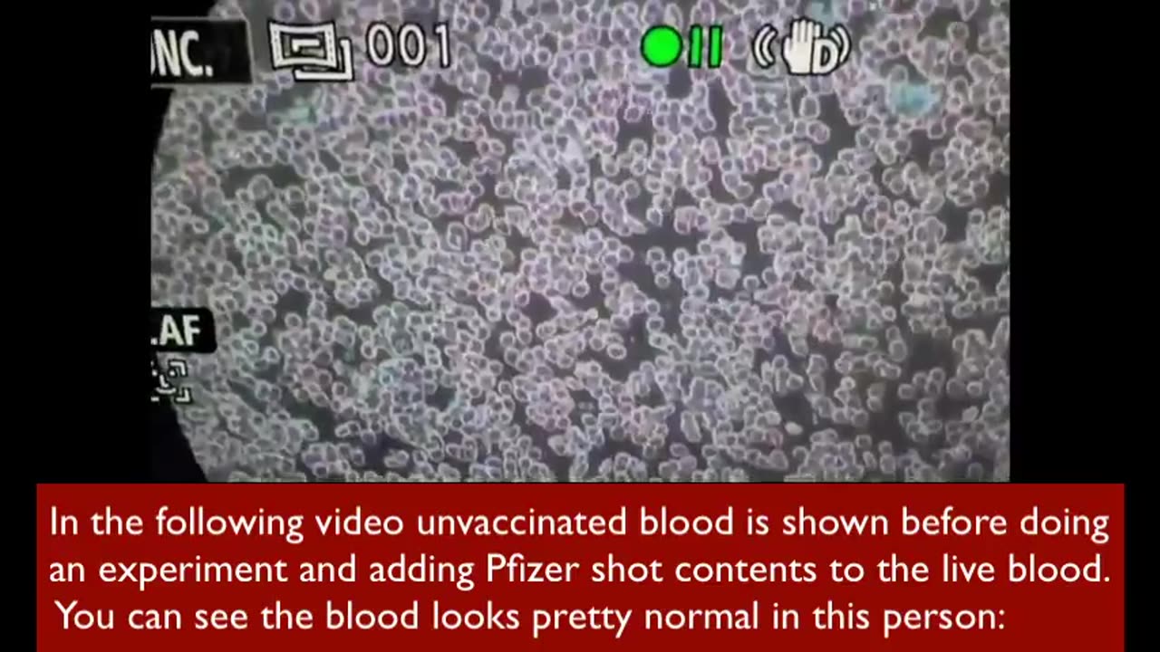 ANALYSIS OF PFIZER C19 SHOT UNDER THE MICROSCOPE, THEN BEFORE & AFTER ADDING TO LIVE BLOOD.