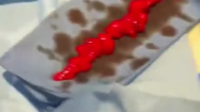 Heart Surgeon Discovers Blood Clots In A Fully Vaccinated 40-Year-Old Athlete