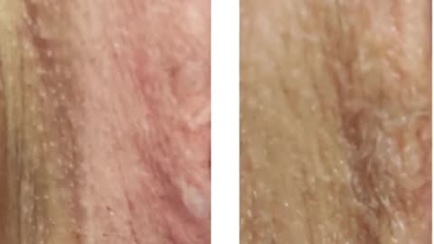 Skin is skin