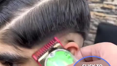 Shy boy finds new confidence after facial hair removel.