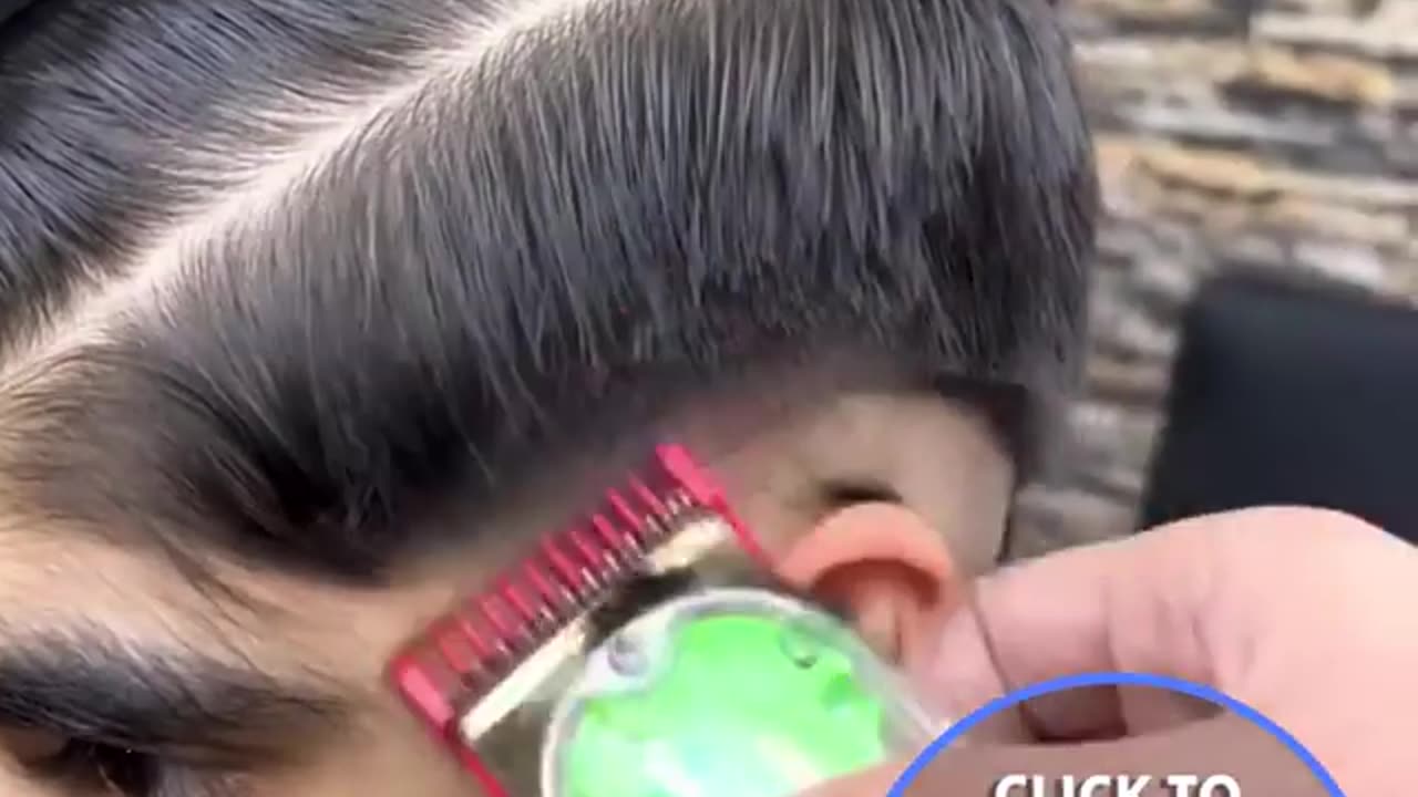 Shy boy finds new confidence after facial hair removel.