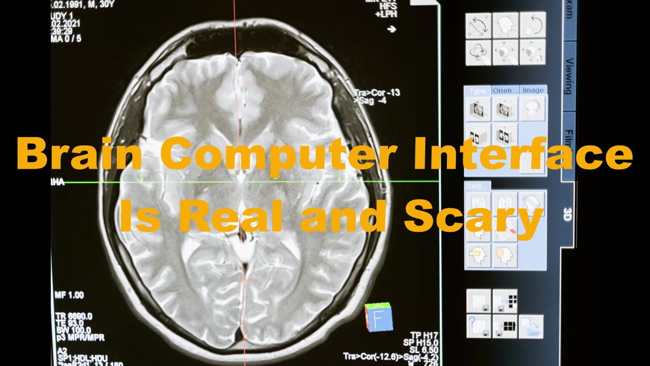 Brain Computer Interface Is Real and Scary