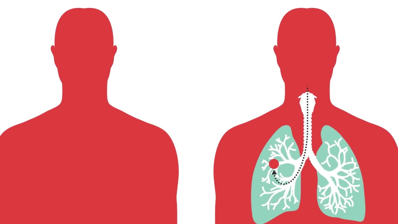 Unraveling Disease X A Comprehensive Guide to the Mystery Coronavirus in China