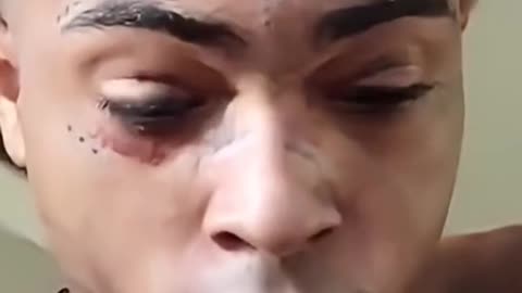 XXX tentacion