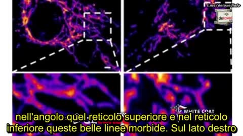 La Spike è una tossina che crea infiammazioni autoimmuni e può arrivare al cervello