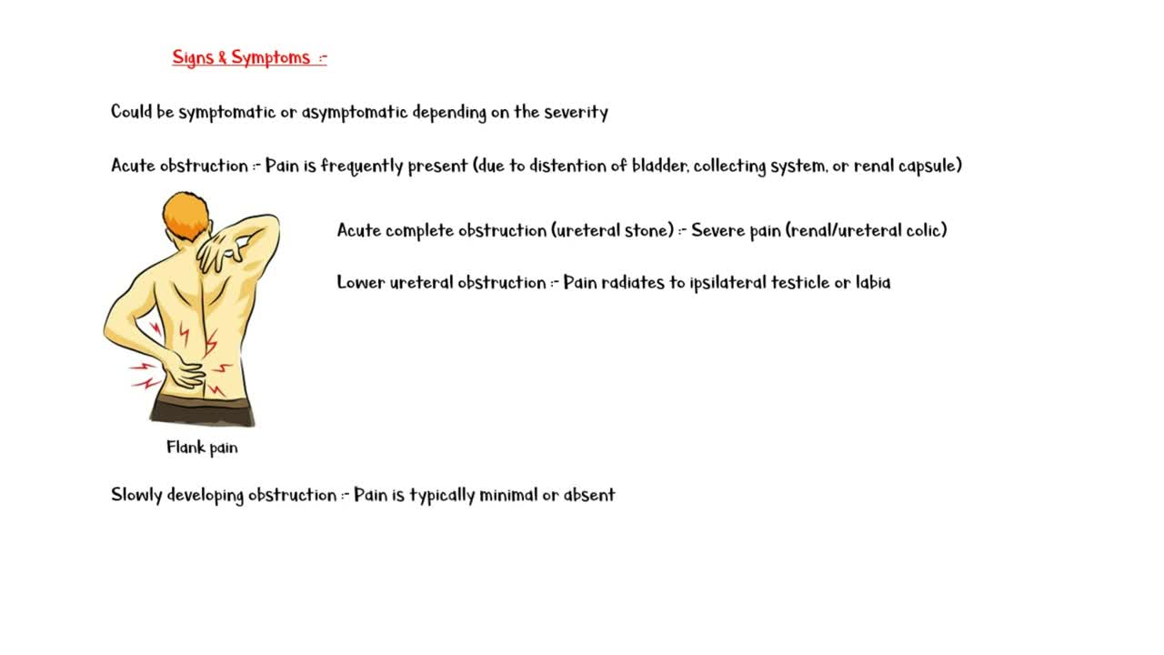 Hydronephrosis _- Definition, Causes, Pathogenesis, Signs & Symptoms, Diagnosis & Treatment