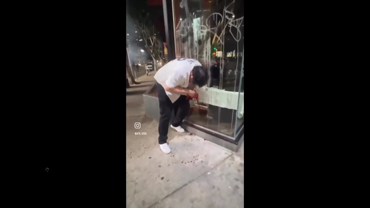 Dodgers fan blew his hand up playing with fireworks (Not for children)