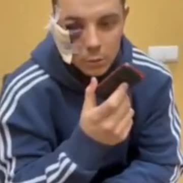 Russian Soldier with battered face is forced to call family