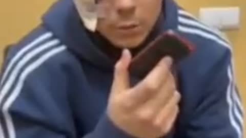 Russian Soldier with battered face is forced to call family