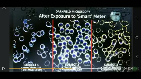 NON-VAXXED and VAXXED BLOOD COMPARISON AND SMART METERS EXPOSURE!