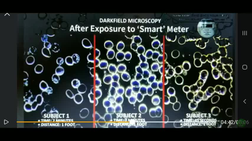 NON-VAXXED and VAXXED BLOOD COMPARISON AND SMART METERS EXPOSURE!