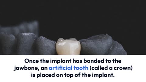 The Different Procedures of Reconstructive Dentistry