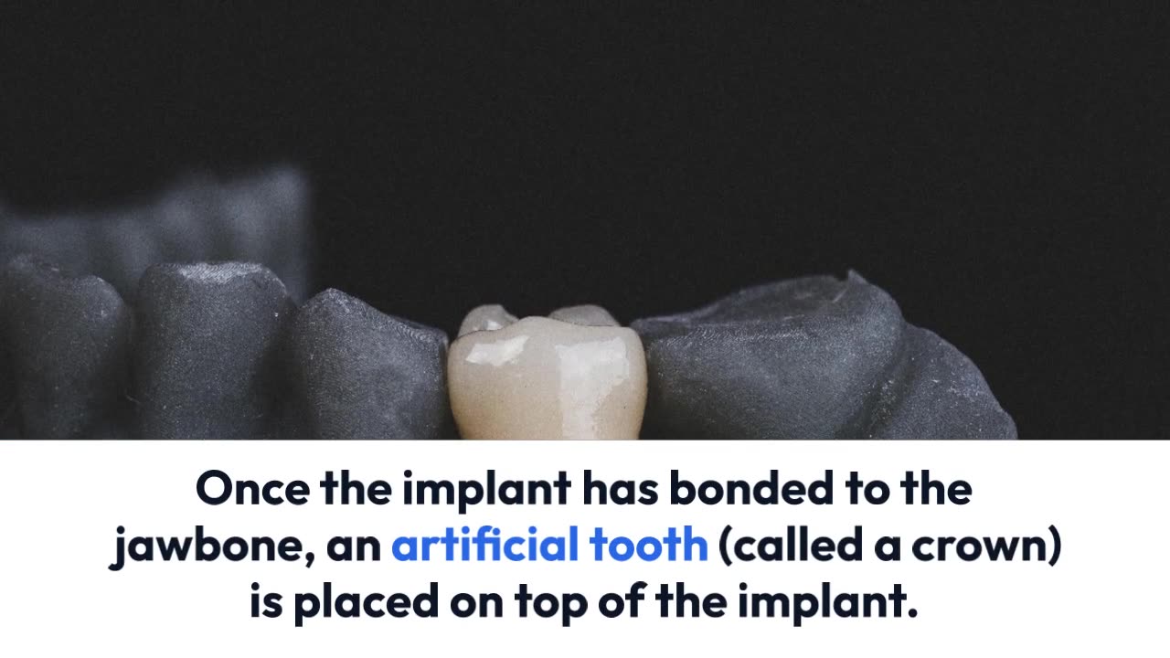 The Different Procedures of Reconstructive Dentistry