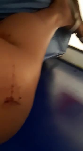 Turista cae en hueco del Centro