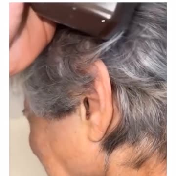 Spider Comes out of Woman's Ear