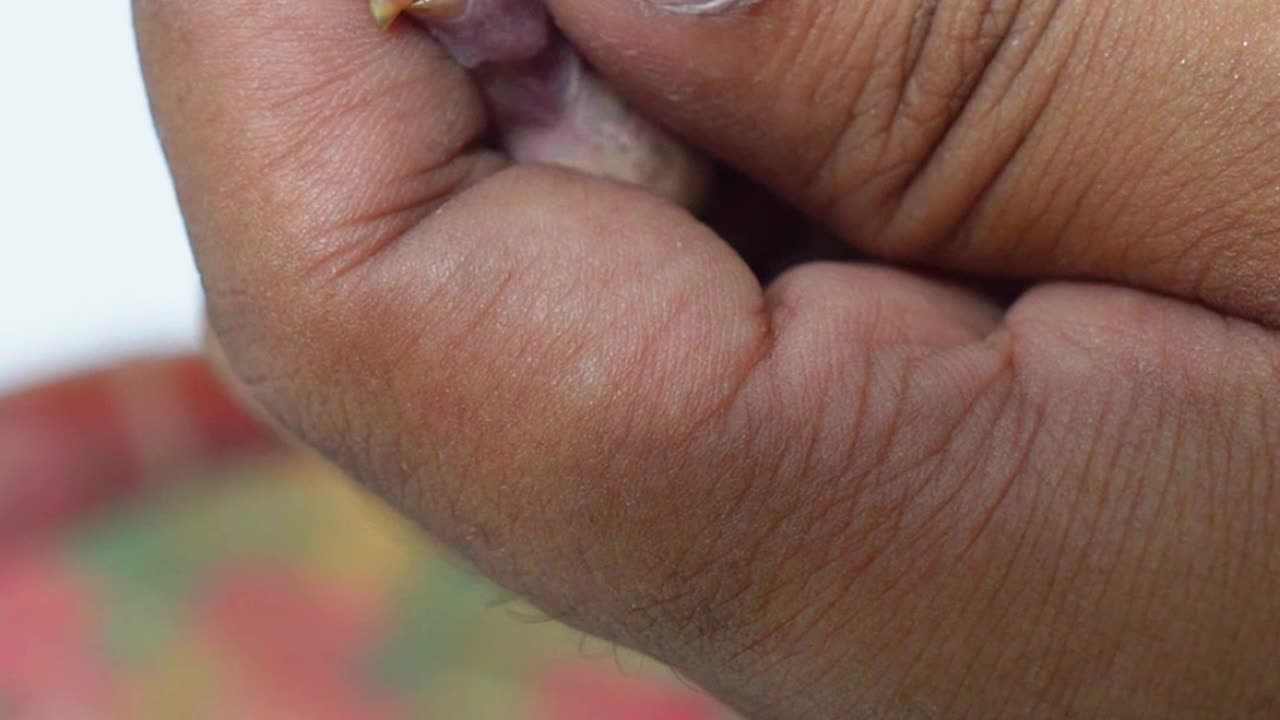 Saving Budgies From Fly Larvae🥺