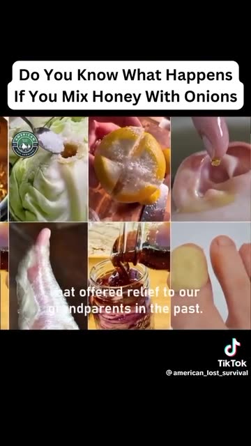 Mix HONEY with ONIONs