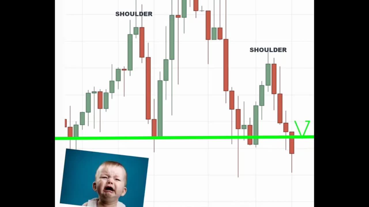 How to Trade Chart Patterns Like A PRO 💯