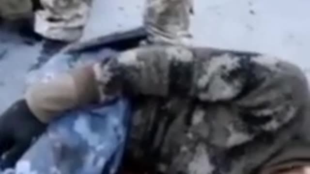 russian prisoners shot in legs