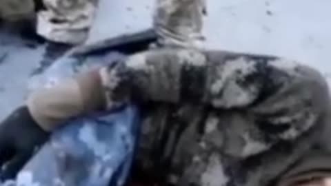 russian prisoners shot in legs