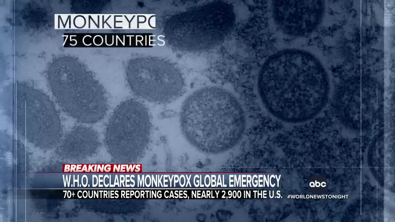 WHO declares monkeypox a global emergency