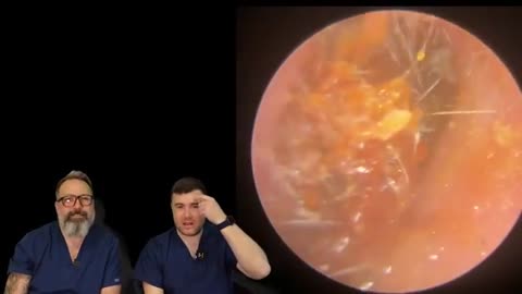 SHOCKING AMOUNTS OF EAR WAX REMOVED - EP4