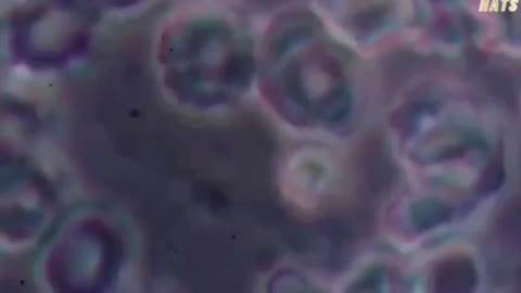 The SHOCKING difference between vaccinated and unvaccinated blood.