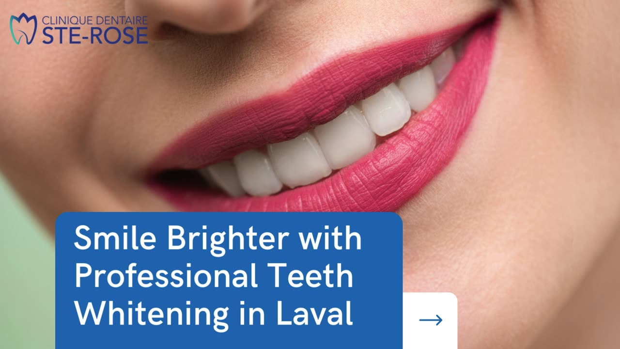 Smile Brighter with Professional Teeth Whitening in Laval