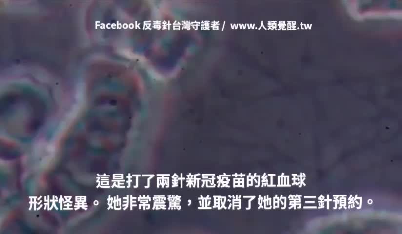 打了兩針的血液。 她非常震驚,並取消了她的第三針預約。 第三劑 追加劑 血栓