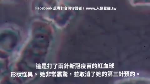 打了兩針的血液。 她非常震驚，並取消了她的第三針預約。 第三劑 追加劑 血栓