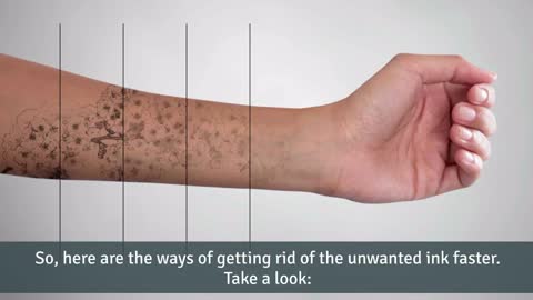 Speed Up Tattoo Removal And Fading