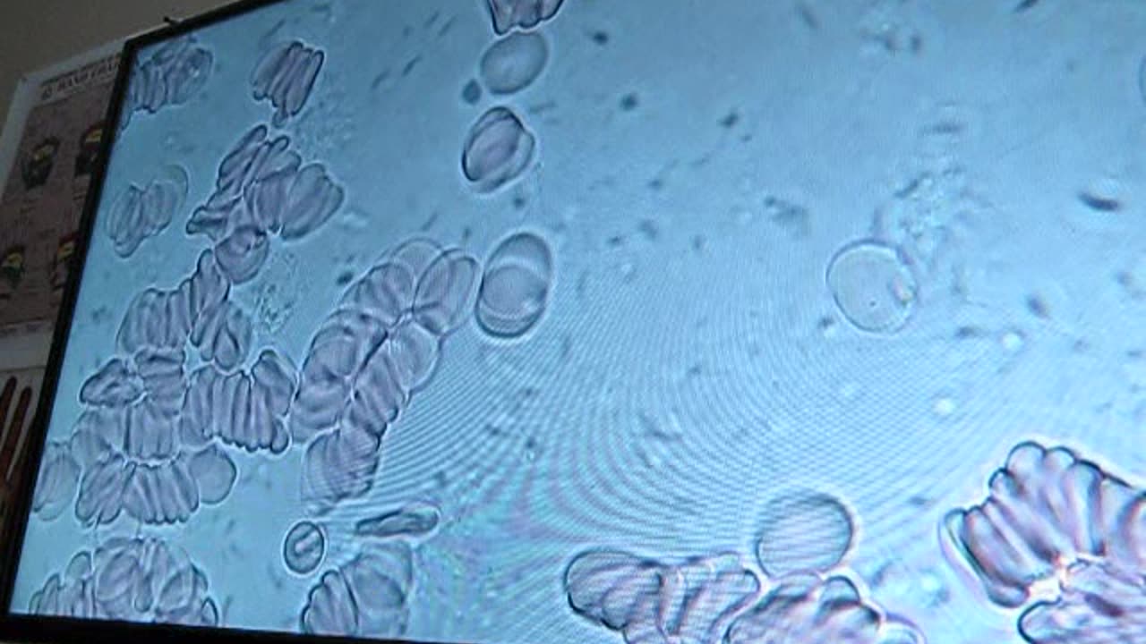 Aldia's Blood Test Nov 19th 2024
