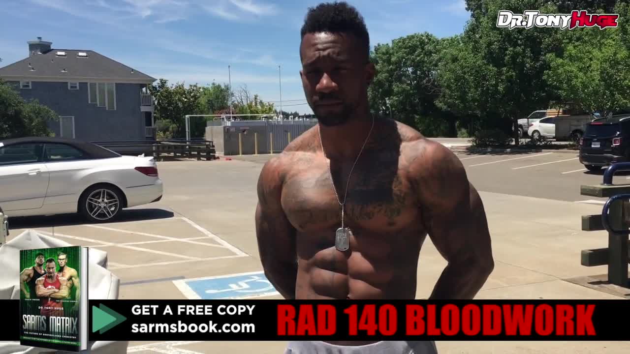Rad 140 (SARM) Bloodwork Results _ 30 mg For 90 days