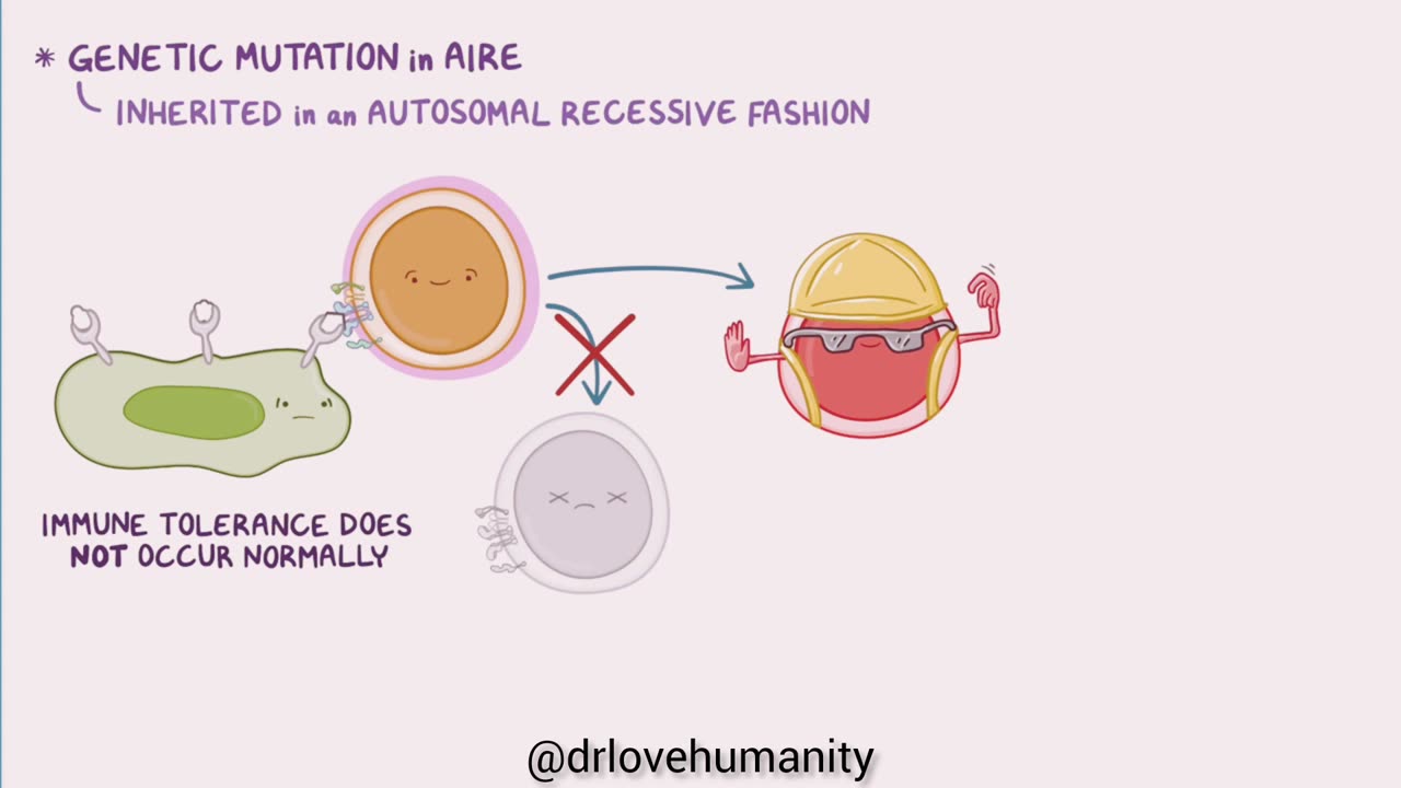 Medical Autoimmune Polyglandular syndrome type 1