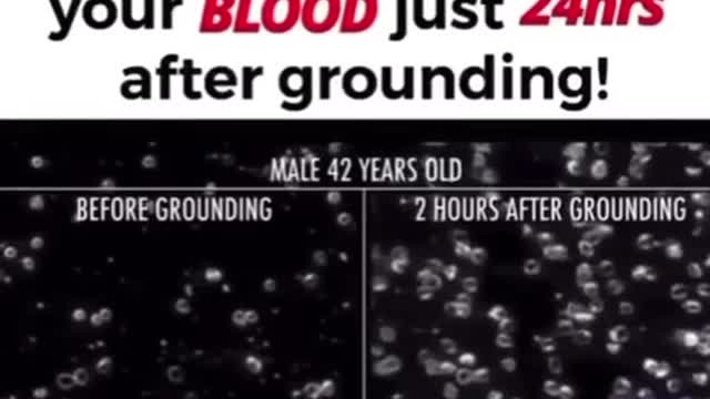 Look What Happens To Your Blood Just 24 Hours After Grounding!